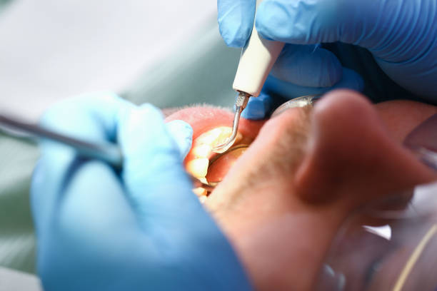 Best Emergency Dental Care for Broken or Chipped Teeth in Juarez, TX