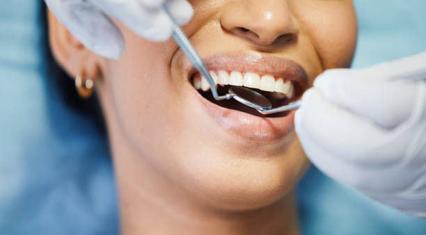 Best Emergency Treatment for Dental Infections or Abscesses in Juarez, TX